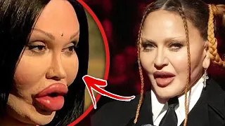 Hollywood Celebrities Who Regret Their BOTCHED Plastic Surgery | Marathon