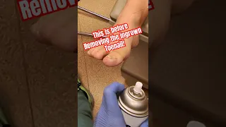 Numbing a toe for an Ingrown Toenail!