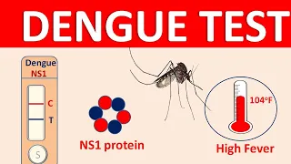Dengue - Symptoms, transmission and diagnosis