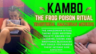 i tried kambo! what is kambo? Amazonian frog poison | Kambo healing vlog | Kambo side effects