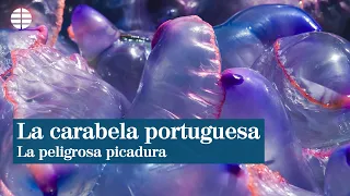 La peligrosa picadura de la carabela portuguesa