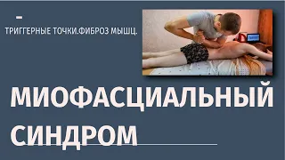 Миофасциальный синдром.Триггерные точки. Фиброз мышц.