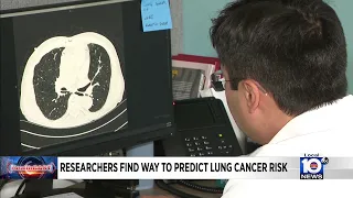 Artificial intelligence aids in lung cancer detection
