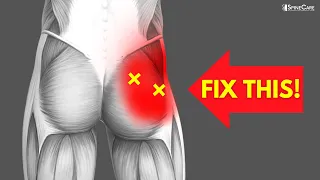 How to Relieve Butt and Hip Pain FOR GOOD
