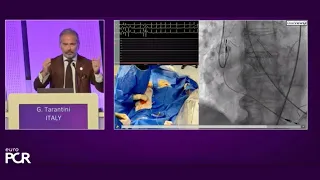 Redo-TAVI and patient pathway optimisation - EuroPCR 2023