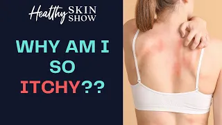 Why You're So Itchy (HINT: It's Probably Not Histamine) | Dr. Shawn Kwatra