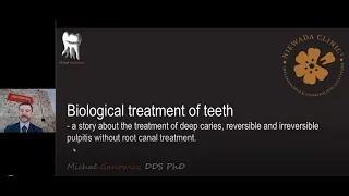 Biological treatment of teeth - Septodont webinar by Dr Ganowicz