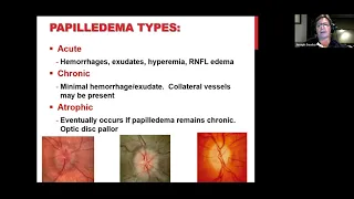 Optic Nerve Grand Rounds