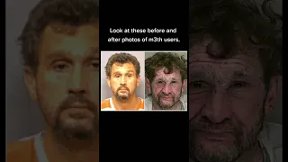 Meth addiction before and after #addiction #fyp #fy #viral