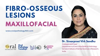 Maxillofacial Fibro-osseous Lesions |Oral Pathology360| Updates