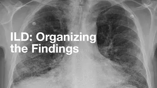 ILD: Organizing the Findings