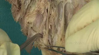 1.9 Step 6. Extraocular muscles and superior division of the oculomotor nerve