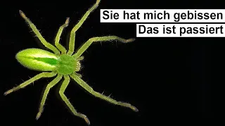 Spinne beißt mich 5 mal hintereinander