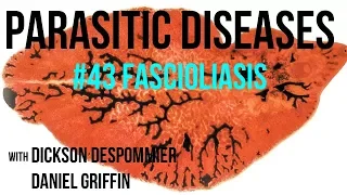 Parasitic Diseases Lectures #43: Fascioliasis