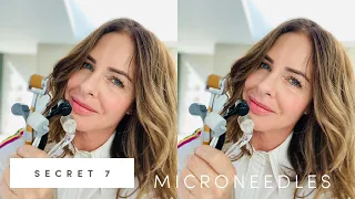 Secret 7: How To Microneedle | Trinny