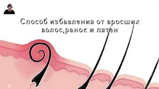 Раскрыт секрет/ Как ИЗБАВИТЬСЯ от ВРОСШИХ ВОЛОС,РАНОК и ПЯТЕН за 3 ДНЯ/ А ты знал?