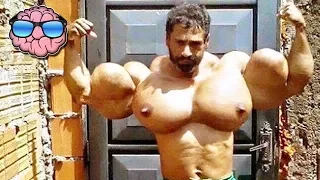 Top 10 Bodybuilders Who Took Bodybuilding Too Far