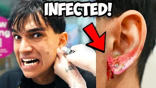 I got my ear pierced and THIS HAPPENED.. *GROSS WARNING*