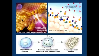 Ольга Мироненко. Путь к здоровым сосудам