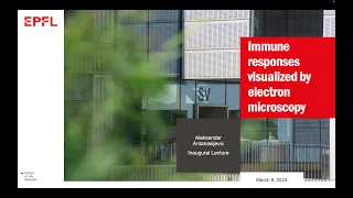 Aleksandar Antanasijevic : immune responses visualized by electron microscopy