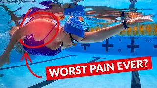 How to Fix Swimmer's Shoulder (and Prevent It)