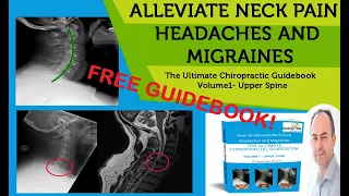 How To Alleviate Neck Pain, Headaches and Migraines The Ultimate Guidebook  🤓 By Dr Craig Hindson DC