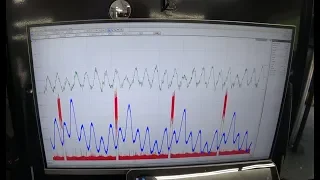 Using an oscilloscope to test head gasket/cracked head