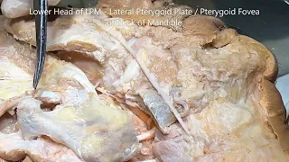 MASTICATION Temporalis Masseter Pterygoid TEMPOROMANDIBULAR Joint Infratemporal Fossa –Sanjoy Sanyal