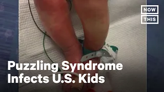 Kids Infected with Syndrome Possibly Linked to COVID-19 | NowThis