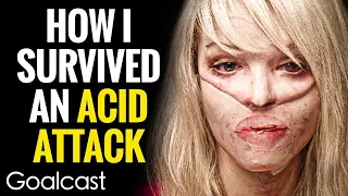 My Facebook Stalker Threw Acid In My Face | Katie Piper | Goalcast