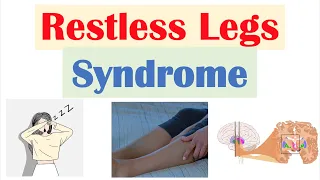 Restless Legs Syndrome (RLS) | Causes, Signs & Symptoms, Diagnosis, Treatment