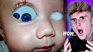 RAREST Human Features You WON'T Believe Exist 2..