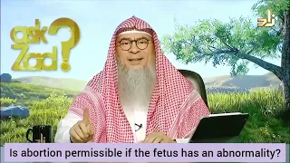 Is abortion permissible if the foetus has an abnormality - Assim al hakeem