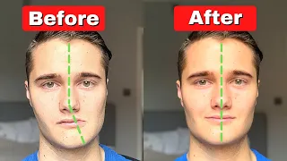 How to Fix Asymmetrical Jaw & Face (TODAY!)