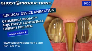 Medical Animation: Medical Device - Uromedica ProACT™  Adjustable Continence Therapy for Men