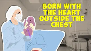 Ectopia Cordis | Born With the Heart Outside the Chest