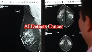 AI tool spots cancers missed by doctors |Mintoo News