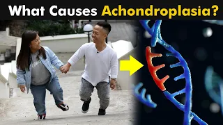 Achondroplasia Disorder | Causes, Symptoms And Treatment
