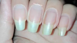 How to Grow your Nails Fast in One Week| Using Garlic and Olive Oil | Rose Pearl