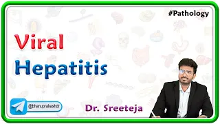 14. Viral Hepatitis | USMLE Step 1 Pathology