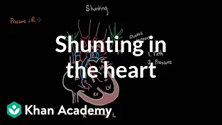 Shunting in the heart | Circulatory System and Disease | NCLEX-RN | Khan Academy