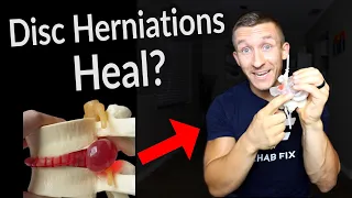 How to Heal a Disc Herniation WITHOUT Surgery! | Fix Your Low Back!