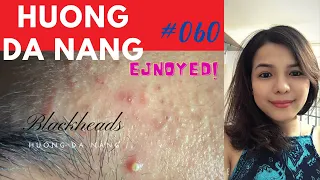 #059 | Blackheads, enjoyed to wach (waved to say hello at end video) | Hương Đà Nẵng