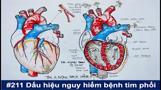 #211. Những dấu hiệu nguy hiểm của bệnh tim mạch, bệnh phổi, và bệnh thận