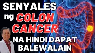 Senyales ng Colon Cancer na Hindi Dapat Balewalain - By Doc Willie Ong (Internist and Cardilogist)