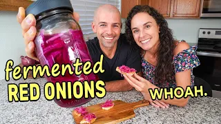 VIRAL RECIPE TEST: Quick Pickled vs. Fermented Red Onions (3 Recipes!)