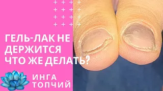 Гель лак на короткие ногти. Не держится. Что делать #13