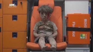 Как выглядят выжившие после бомбардировок в Алеппо