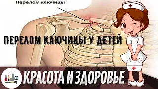 Перелом ключицы у детей