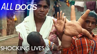 Kaleem Mohammed Massive Hands 😱 | S01 E03 | Extraordinary People Documentary | All Documentary